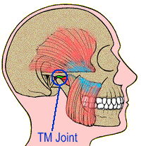 tmj sufferer